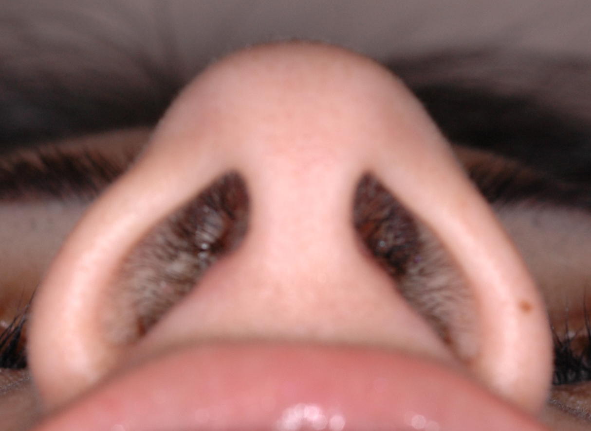 nose bottom view